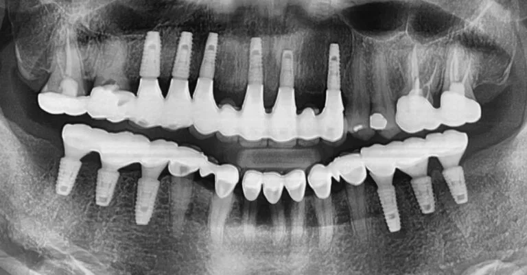 Stories_KJI_05_final