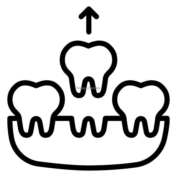 When Saving a Tooth Isn’t Possible: A Guide to Safe Extractions